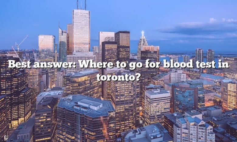 Best answer: Where to go for blood test in toronto?