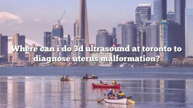 Where can i do 3d ultrasound at toronto to diagnose uterus malformation?