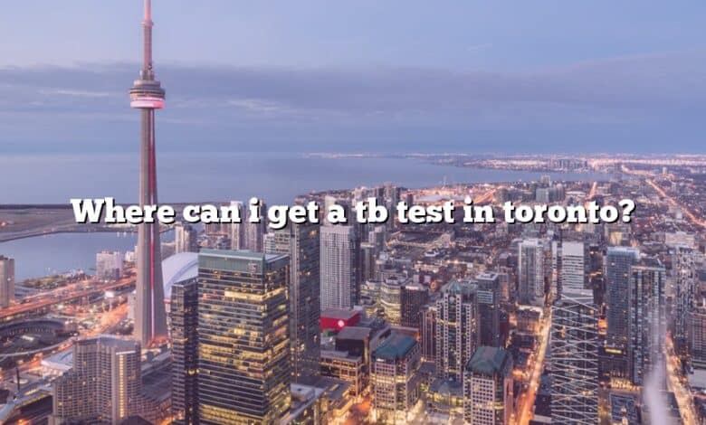 Where can i get a tb test in toronto?